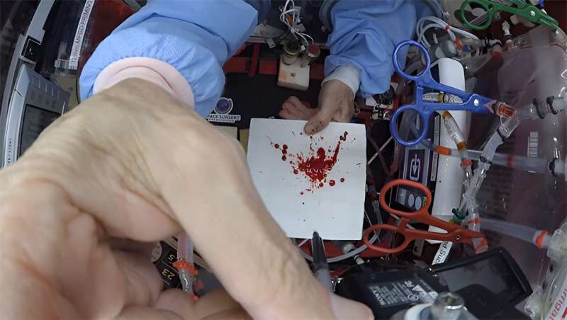 CSI in space: Analyzing bloodstain patterns in microgravity