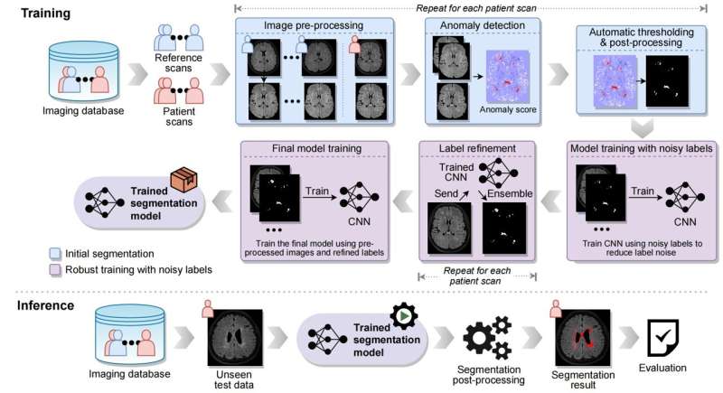 DeepWMH: a deep learning tool for accurate white matter hyperintensity segmentation without requiring manual annotations for training