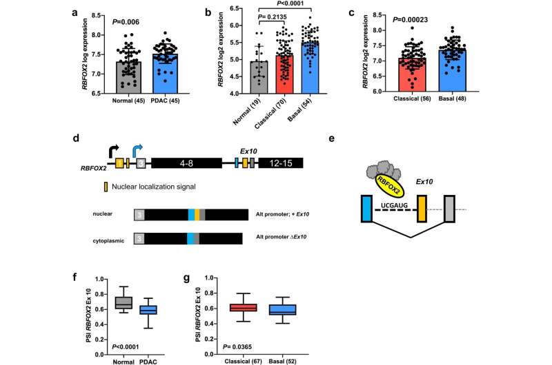 Deregulation of alternative RNA splicing promotes pancreatic cancer progression and metastasis