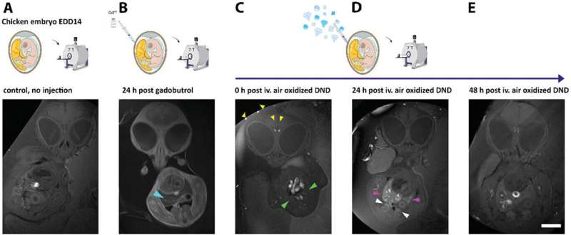 Diamond dust as potential alternative to contrast agent gadolinium in magnetic resonance imaging
