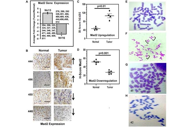 Differential expression of Mad2 gene in human esophageal cancer
