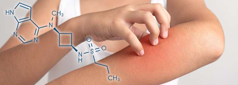 Drug used to treat eczema may provide relief for patients with intensely itchy skin diseases