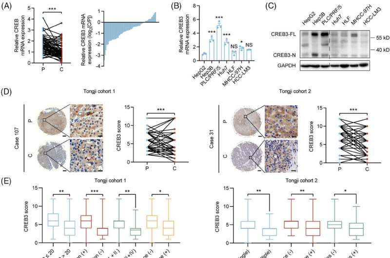 Dual inhibition of cAMP responsive element binding protein 3 on AKT signaling supresses hepatocellular carcinoma