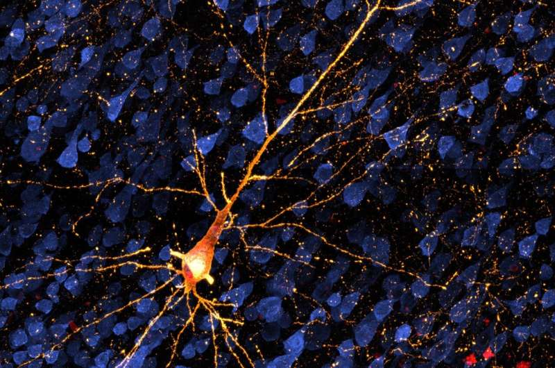 Exploring early stage Alzheimer's disease