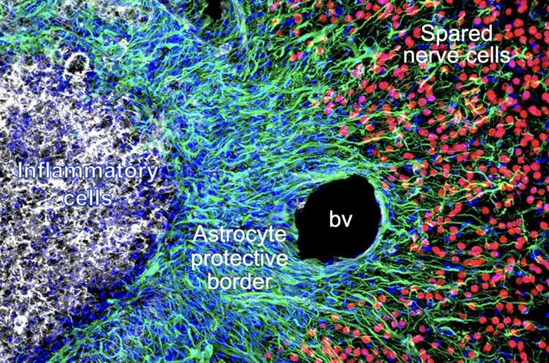 Exploring how astrocytes respond to spinal cord injury or stroke-induced tissue damage