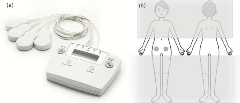 Exploring the effectiveness of a novel pain management device for endometriosis pain