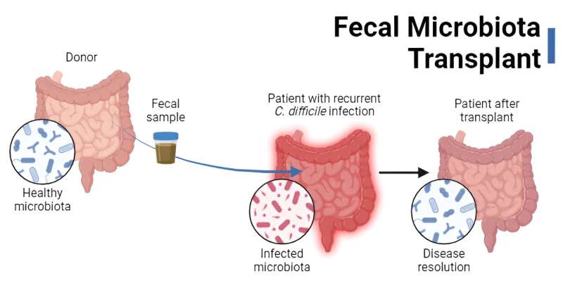 Fecal Microbiota Transplants (FMT): Past, Present and Future