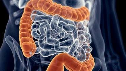 Fecal occult blood testing tied to reduction in colorectal cancer mortality