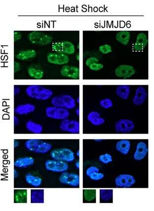 Feedback loop' promotes cancer cells' adaption to molecular stress