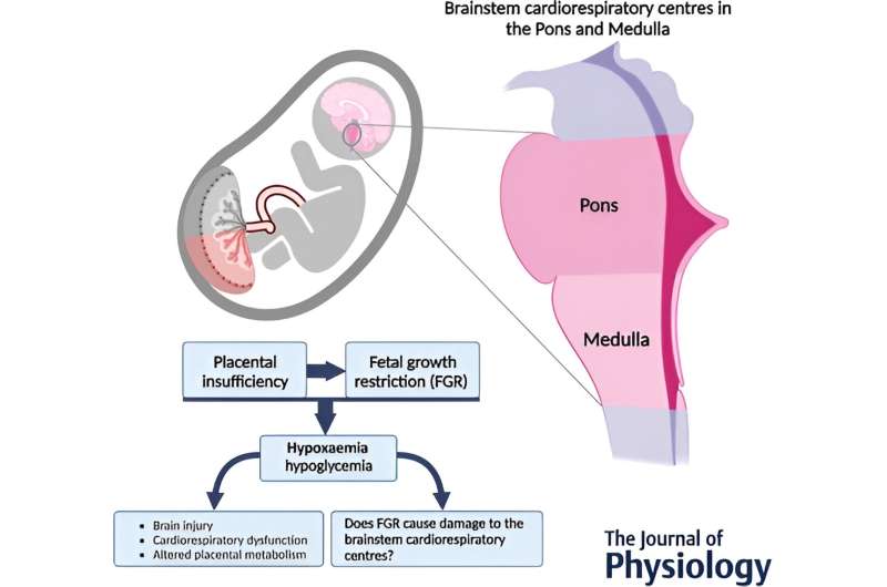 Fetal growth restriction harms the heart and lungs via the brainstem