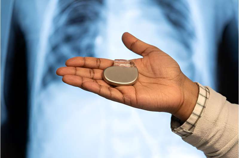 Finding ways to reduce the financial and social costs of pacemakers