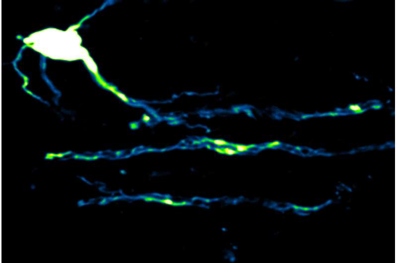 Firing nerve fibers in the brain are supplied with energy on demand