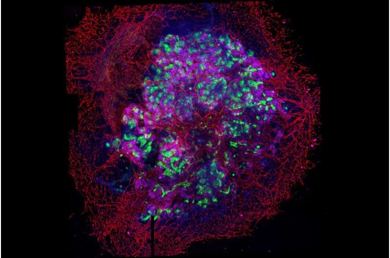 For the first time scientists managed to generate kidney organoids with a complex vascular system