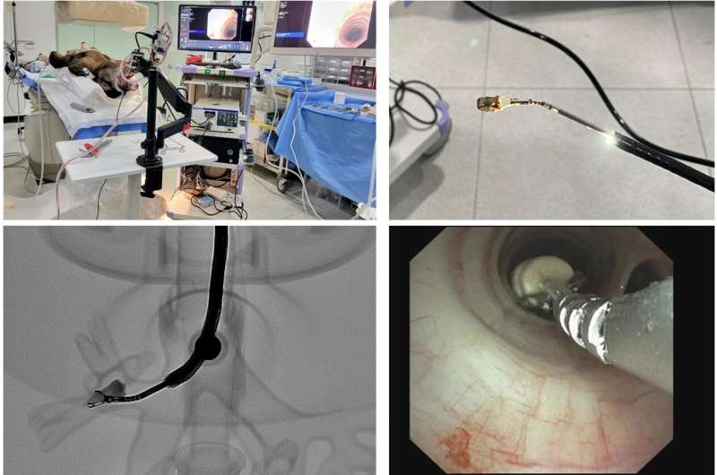 Foreign substance inhalation accidents in infants and young children can immediately be resolved by using an endoscopic robot