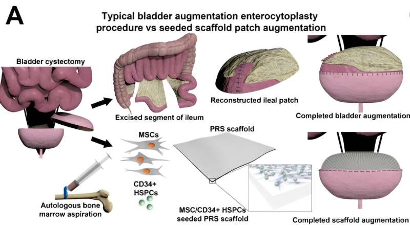 Functional bladder tissue regenerated using bone marrow cells