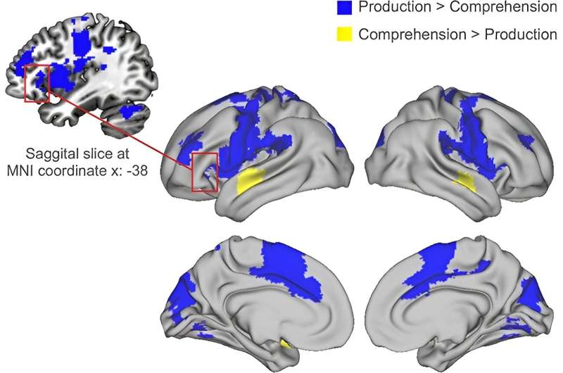 Functional MRI scans provide a novel view of the brain's language network during conversation