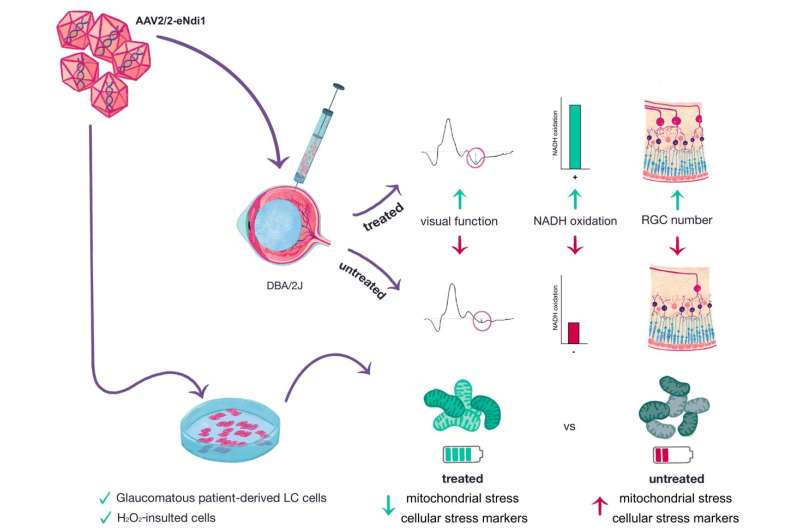 Gene therapy offers promise for treating glaucoma and AMD