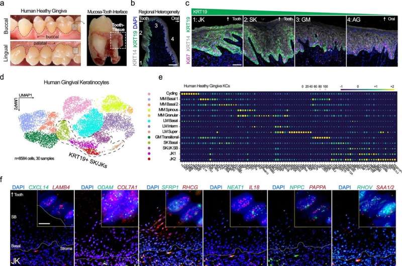 Genetic atlas shows gum disease may be caused by immunosuppression of skin cells in the mouth
