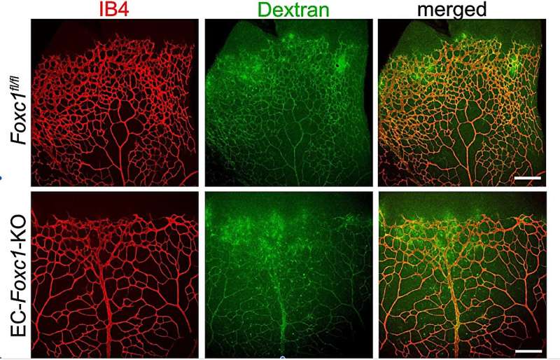 Genetic mechanisms may reveal retinal vascular disease therapeutic targets