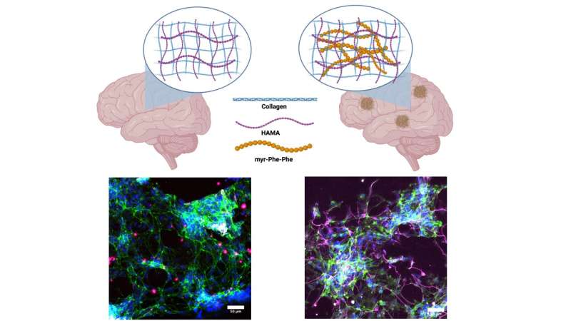 Groundbreaking study reveals insights into Alzheimer's disease mechanisms through novel hydrogel matrix