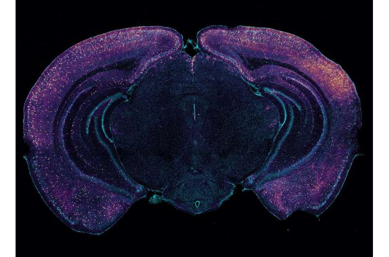 How 40Hz sensory gamma rhythm stimulation clears amyloid in Alzheimer's mice