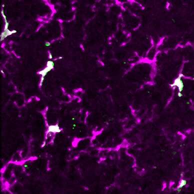 How myeloid cell replacement could help treat autoimmune encephalomyelitis