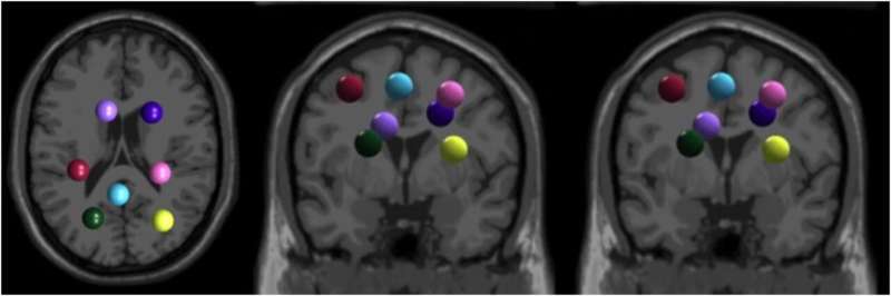 Comment notre cerveau apprend rapidement de nouvelles compétences athlétiques : étude de l'activité électrocorticale et d'une adaptation locomotrice plus rapide