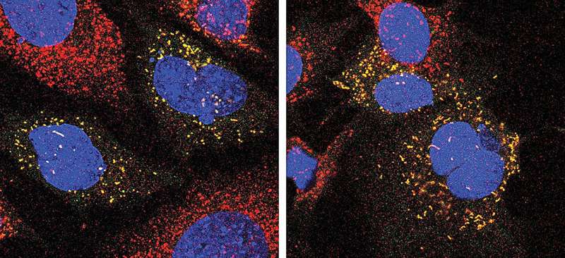 Improved cellular recycling could benefit patients with neurodegenerative conditions