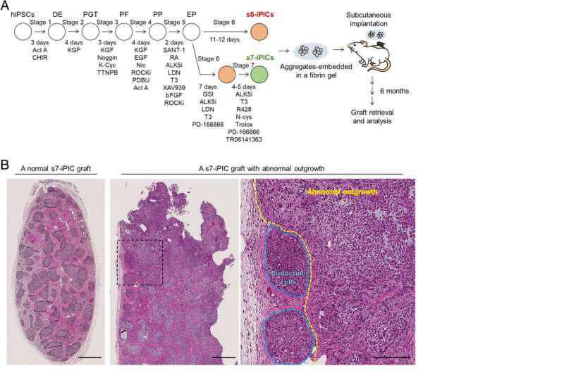 Improving the safety of iPS cell-derived pancreatic islets by eliminating unwanted cells