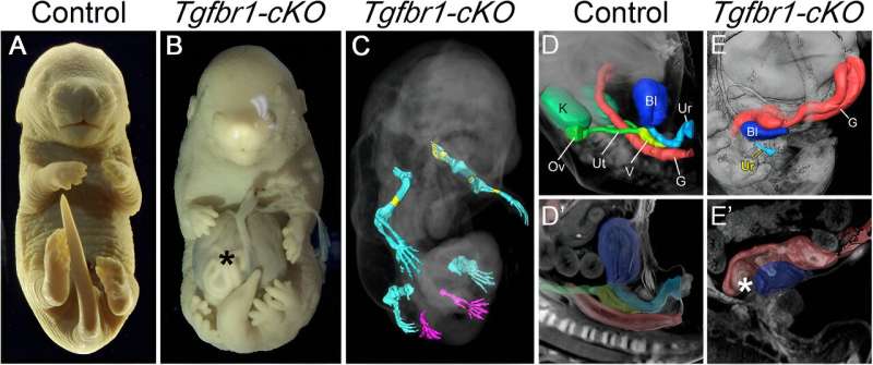 Inactivating Tgfbr1 gene in mouse embryos results in extra limbs and no external genitals