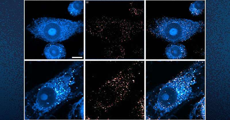 Innovative microscopy demystifies metabolism of Alzheimer's