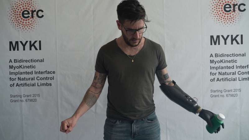 "It feels like I'm moving my own hand". A research team from the Scuola Superiore Sant'Anna in Pisa has developed the prosthesis of the future, the first in the world with magnetic control