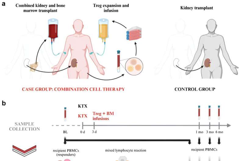 Kidney transplantation: Combined cell therapy found to reduce donor-specific immune response