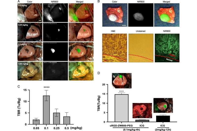 Korea University - Harvard Medical School joint research team developed "Precise and safe pulmonary segmentectomy with dual-channel fluorescence imaging"