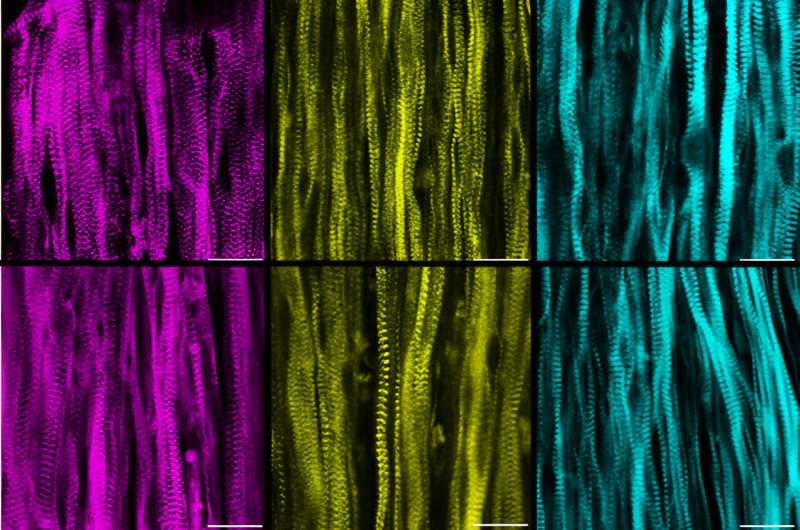Lab-grown muscles reveal mysteries of rare muscle diseases