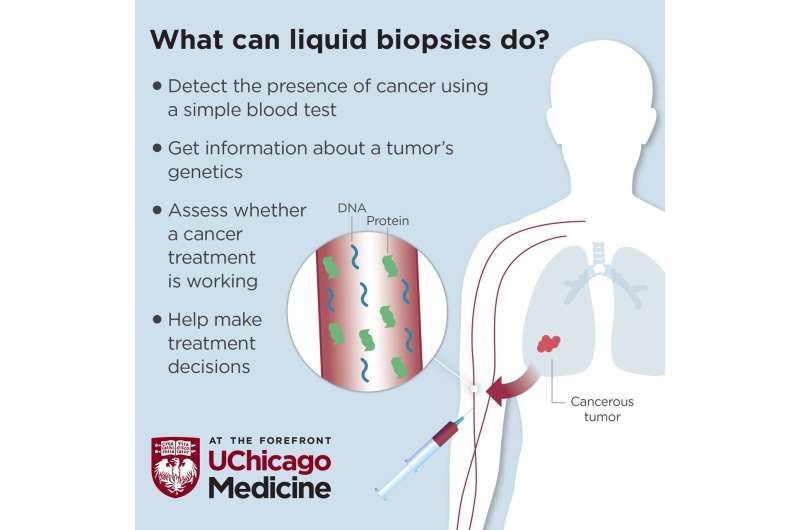 Liquid biopsy: A new tool for identifying and monitoring cancer