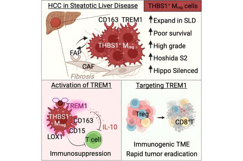 Liver cancer: A promising avenue for more effective immunotherapies
