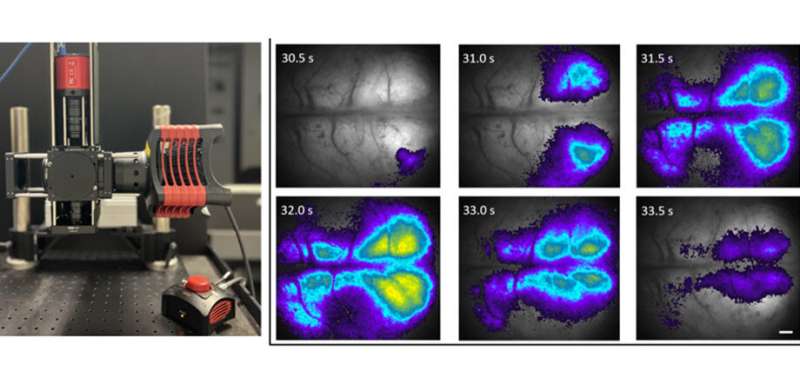 Low-cost versatile mesoscope makes brain imaging in rodents more accessible