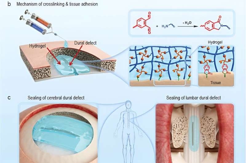 Low-swelling hydrogel sealant for sealing of dural defect and prevention of postoperative adhesion