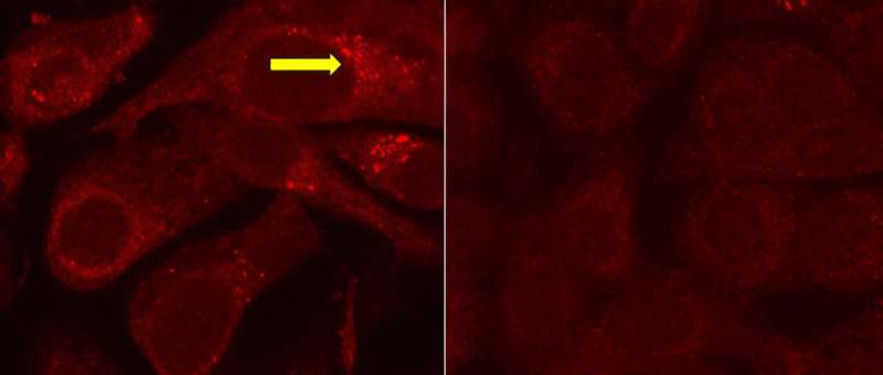 Lung cancer cells protected from cigarette smoke damage, researchers find