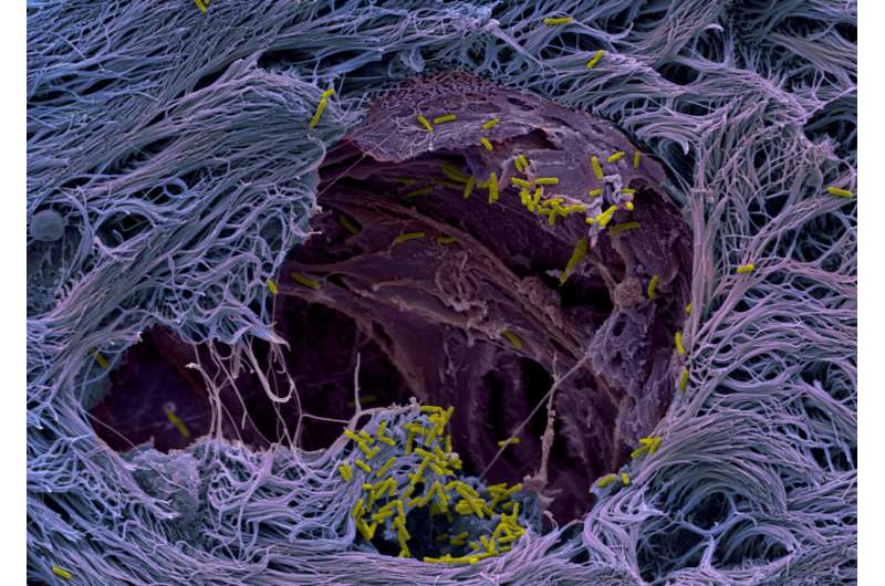 Lung organoids unveil secret: How pathogens infect human lung tissue