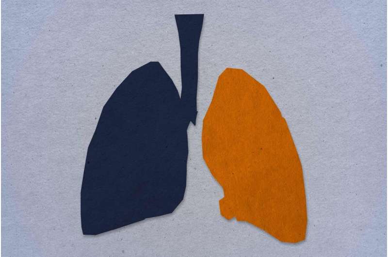 Lung transplant discovery could improve survival rates