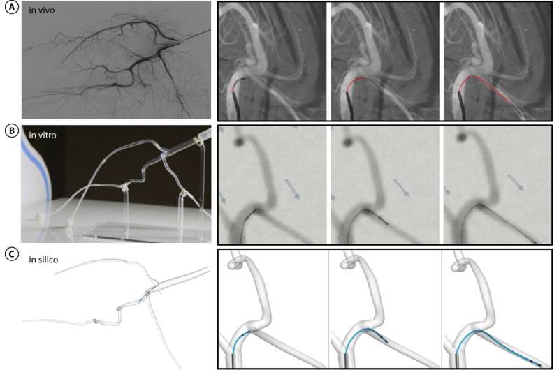 Magnetically operated robot can move through arteries to treat stroke patients