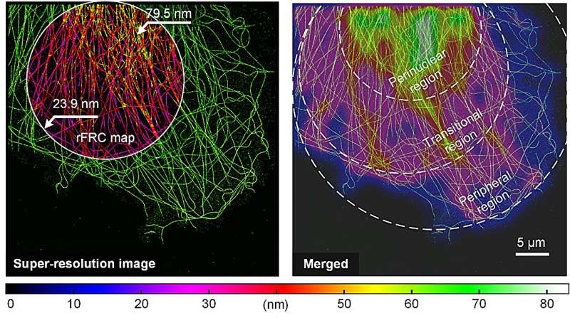 Mapping local quality at super-resolution scale