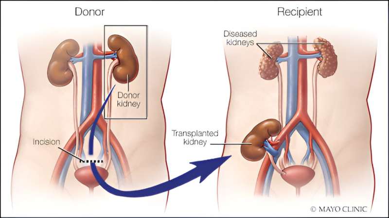 Mayo Clinic Minute: Expanding the living kidney donor pool to those with Type 2 diabetes