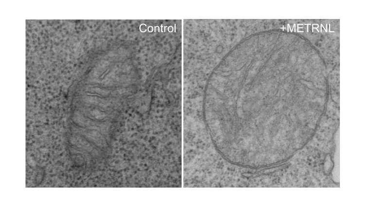 Meteorin-like protein drains energy from T cells, limiting immune system's power to fight cancer