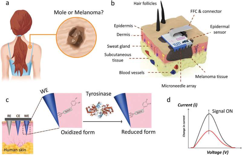 Microneedle patch can detect skin cancer early