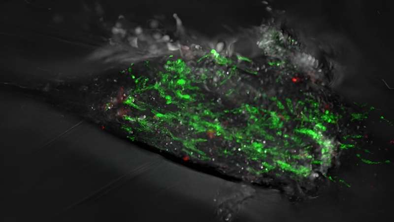 Mitochondrial DNA fragment losses predict Parkinson's disease before symptoms appear