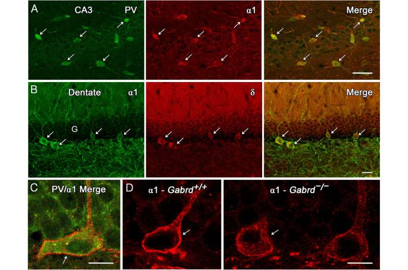 Molecule restores cognition, reminiscence in Alzheimer’s illness fashion mice