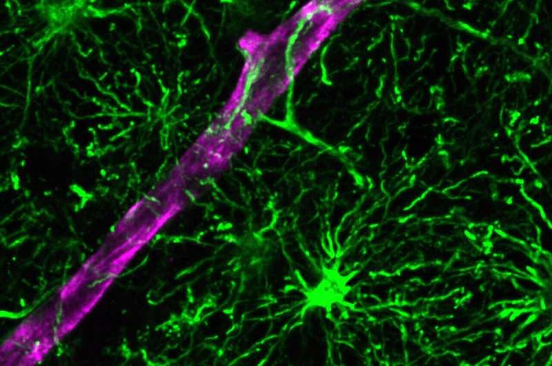 More than just neurons: A new model for studying human brain inflammation